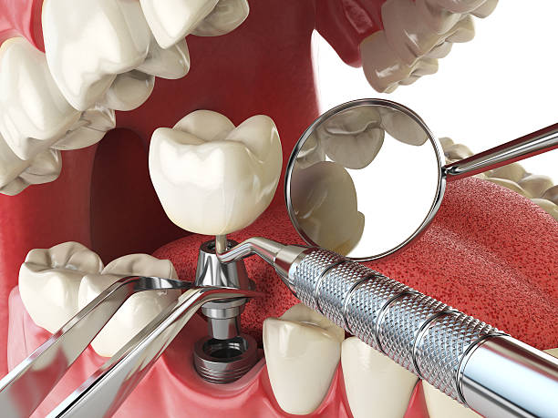 Best Weekend Emergency Dentist in Calvert City, KY